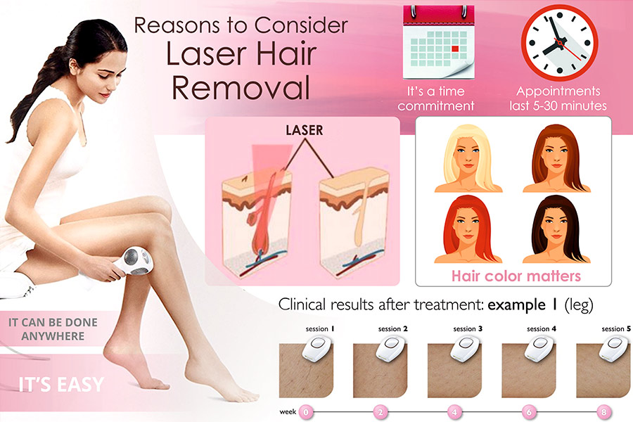 Comparison of Laser Hair Removal Systems