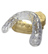 J&S Dental Upper Night Guard